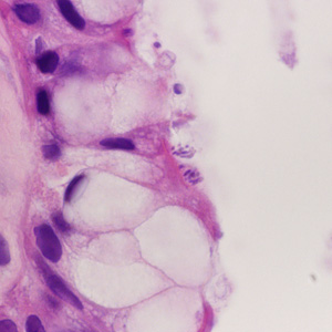 Case428_C.jpg Figure C