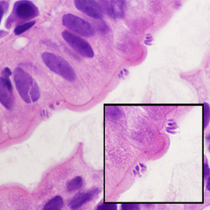 Case428_D.jpg Figure D