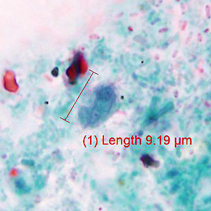 Case429_B.jpg Figure B