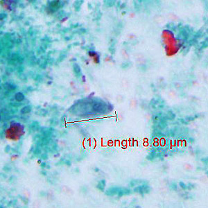 Case429_C.jpg Figure C