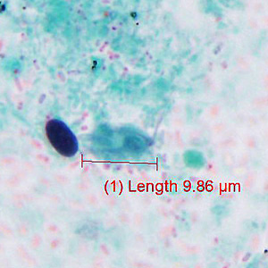 Case429_D.jpg Figure D