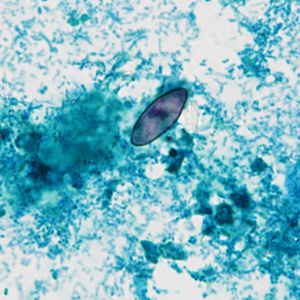 Case430_B.jpg Figure B