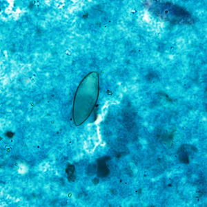 Case430_C.jpg Figure C