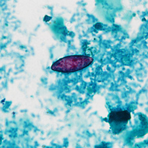 Case430_D.jpg Figure D