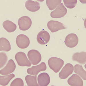 Case431_B.jpg Figure B