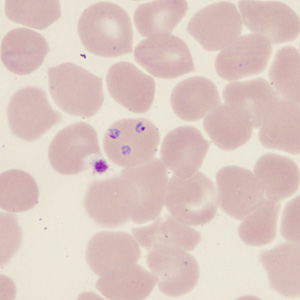 Case431_C.jpg Figure C