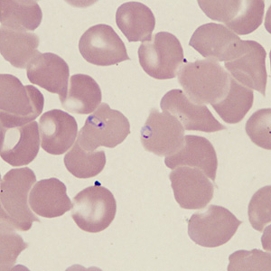 Case431_D.jpg Figure D