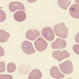 Case431_E.jpg Figure E