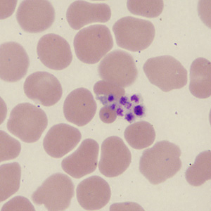 Case431_F.jpg Figure F