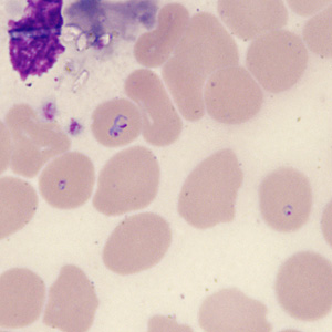 Case431_G.jpg Figure G