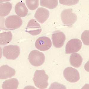 Case431_H.jpg Figure H