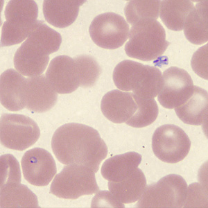 Case431_I.jpg Figure I