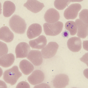 Case431_J.jpg Figure J