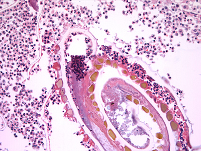 Case432_B.jpg Figure B