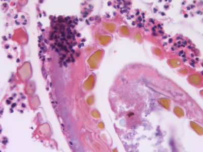 Case432_D.jpg Figure D