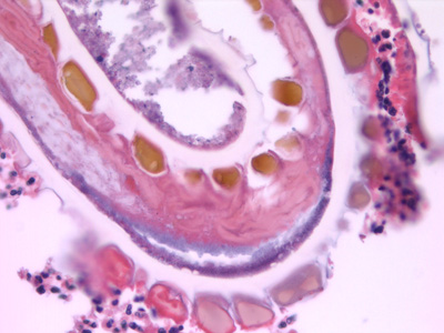 Case432_E.jpg Figure E