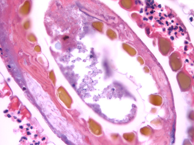 Case432_F.jpg Figure F