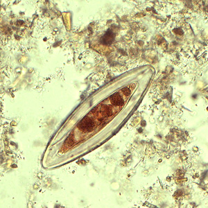 Case433_B.jpg Figure B