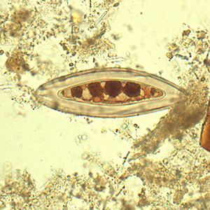 Case433_D.jpg Figure D