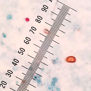 Case434_B.jpg Figure B