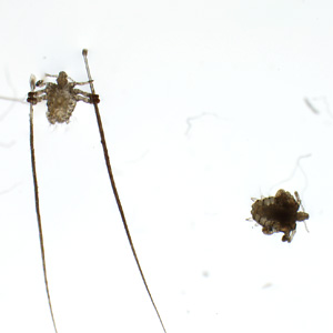 Case435_B.jpg Figure B