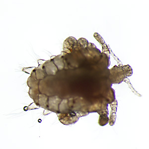 Case435_D.jpg Figure D