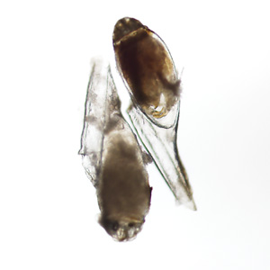 Case435_E.jpg Figure E