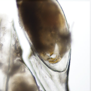 Case435_F.jpg Figure F