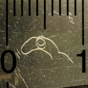 A 31-year-old female, with travel to Mexico a few months prior, noticed a small worm-like object on the inner surface of her lower lip.
