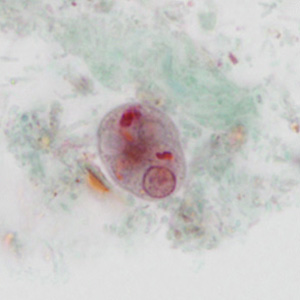 case440_C1 Figure C (Focal Plane 1)