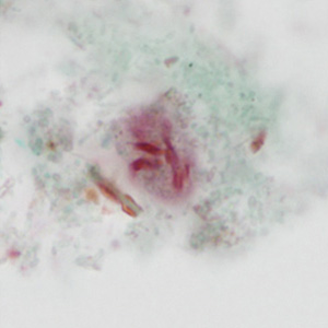 case440_C2 Figure C (Focal Plane 2)