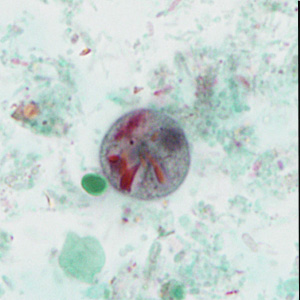 case440_D1 Figure D (Focal Plane 1)