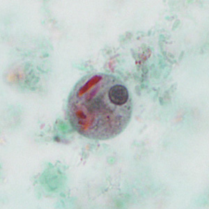 case440_D2 Figure D (Focal Plane 2)