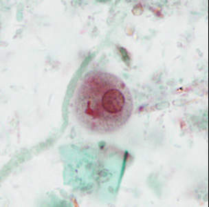 case440_E1 Figure E (Focal Plane 1)