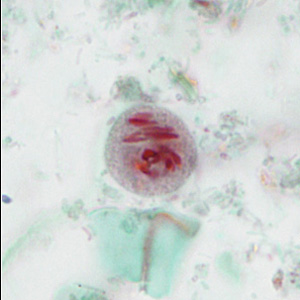 case440_E2 Figure E (Focal Plane 2)