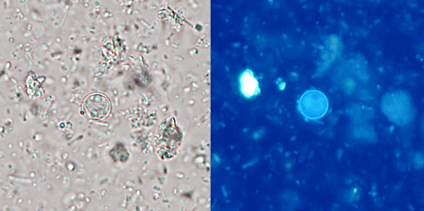 Figure B