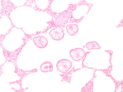 Case448_A parasitic image