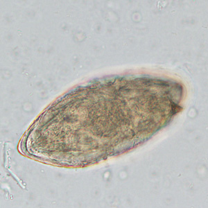 Case449_A parasitic image