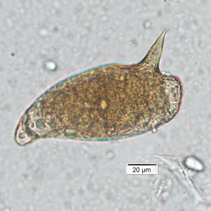 Case449_B parasitic image