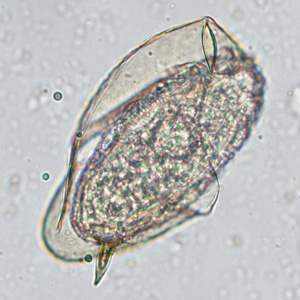 Case449_C parasitic image