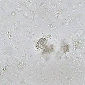 SEPTEMBER - 2017 - Case #452 Case Study Image