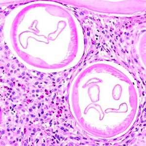 Case454_B parasitic image