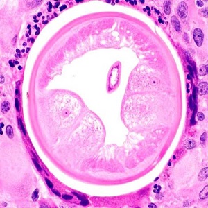 Case454_D parasitic image