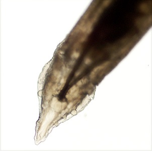 Case455_D Parasitic image