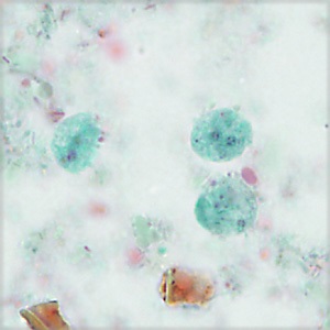 Case456_A parasitic image
