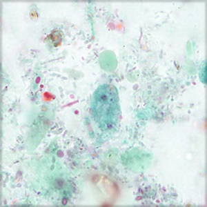 Case456_C parasitic image