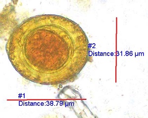 Case457_A.jpg parasitic image