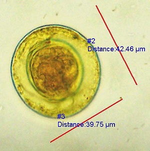 Case457_B.jpg parasitic image
