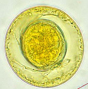 Case457_C.jpg parasitic image