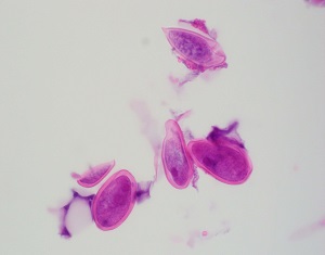 Case458_C parasitic image